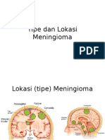 Tipe Dan Lokasi Meningioma