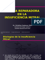 Alternativas Quirurgicas Plastía Mitral