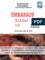 Embarazo Ectopico