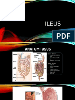 Ileus