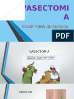 VASECTOMIA