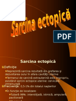 Sarcina Ectopica Mola
