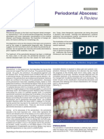 Periodontal Abscess