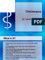 Chickenpox: By: Health-Saviours™