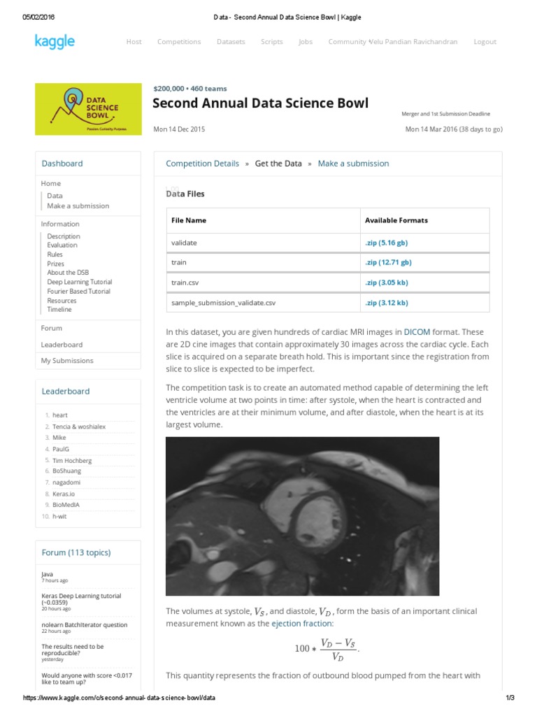 Data second annual data science bowl kaggle pdf ejection