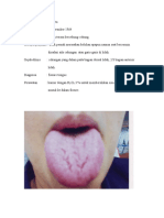Fissure Tongue