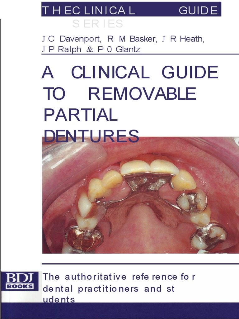 A Clinical Guide To Removable Partial Dentures PDF Periodontology Dentures