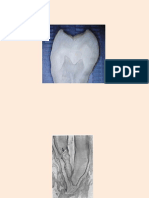Abordarea Clinică a Spaţiului Endodontic În Funcţie de Particularităţile Morfo-funcţionale Ale Fiecărui Dinte