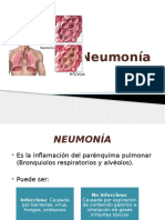 Neumonia Practicas