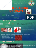 Policitemia Neonatal