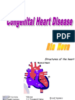 It 3 - Penyakit Jantung Bawaan - Ria