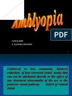 Amblyopia RHP