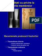 1 - Fracturi - Generalitati