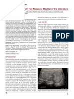 Thyroid Carcinoma in Hot Nodules Review of The Literature