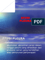 Efusi Pleura