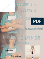 Episiotomia y Episiorafia312