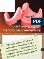 Mandibular Overdenture PDF