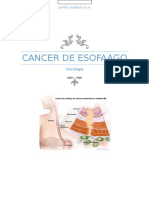 Cáncer de Esófago