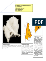 LP Temporal, Occipital