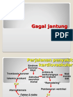 Gagal Jantung
