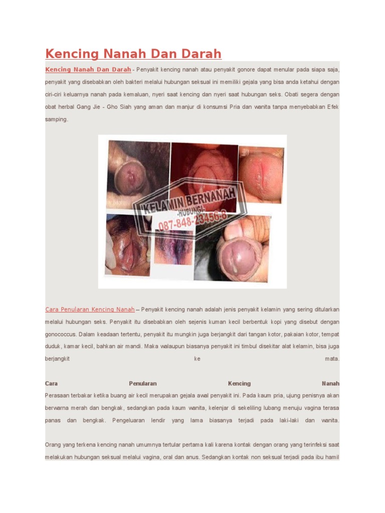 Alat Kelamin Laki Laki Mengeluarkan Nanah Berbagai Alat Alat Kelamin Laki Laki Mengeluarkan Nanah Berbagai Alat