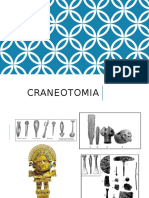 Craneotomias