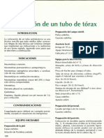 Colocación de Un Tubo de Tórax