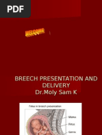 Different types of breech presentation image