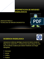 Incidencias e Interpretacion de Imágenes Radiologicas