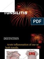 Tonsilitis