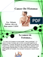 Le Cancer de L'estomac