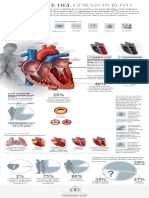 Infografía: Síndrome Del Corazón Roto