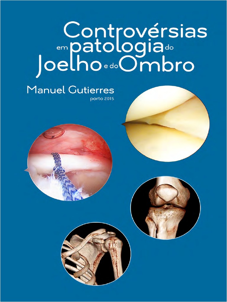 Livro Ombro Joelho, PDF, Osteoartrite