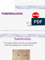 Tuberkulosis