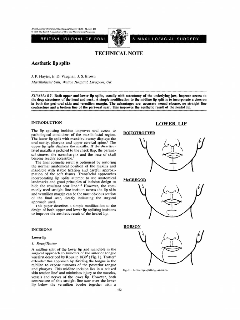 A Simple Modification to Lip Splitting Incisions Improves Aesthetic