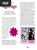 osteoporosis the bone thief 0