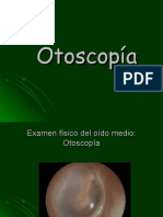 Otoscopía