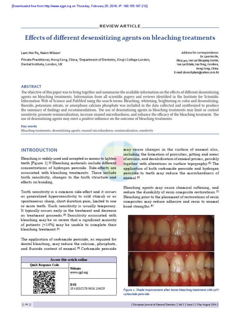 Effects of Different Desensitizing Agents on Bleaching Treatments