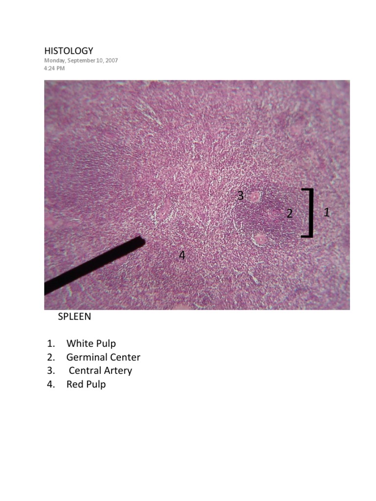 Spleen Histology Overview | PDF