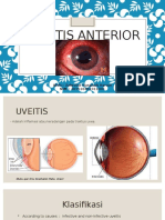 UVEITIS ANTERIOR PENYAKIT