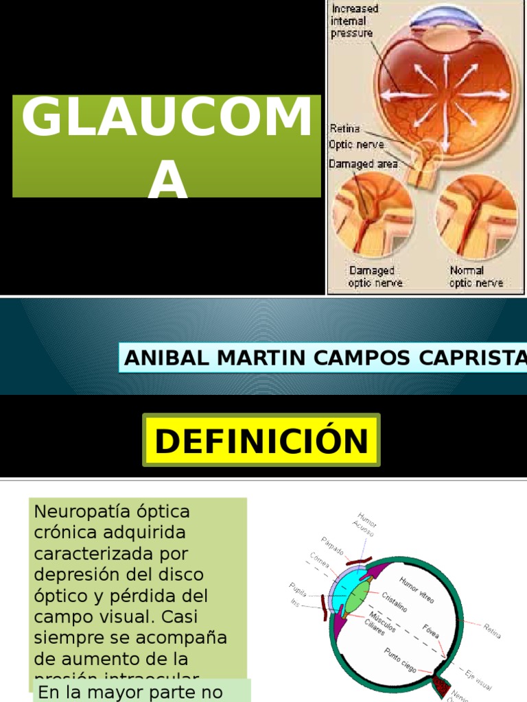 Glaucoma: Escotoma y Membrana de Barkan | PDF | Ojo humano | Sistema visual