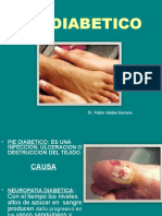 Pie diabético: causas, síntomas y prevención