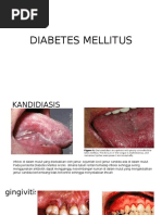 Download Penyuluhan Gigi Prolanis by Aninda Wulan Pradani SN303318704 doc pdf