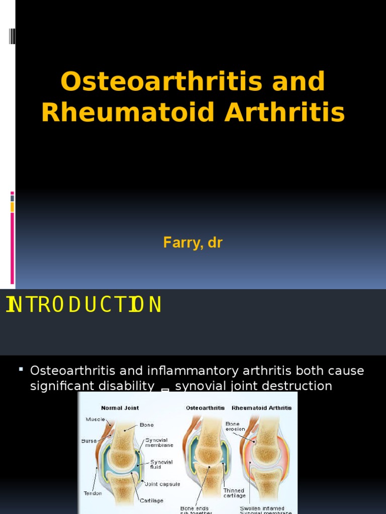 Comparing the Mechanisms and Treatment of Osteoarthritis and Rheumatoid ...