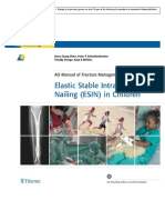 Elastic Stable Intramedullary Nailing (ESIN) in Children