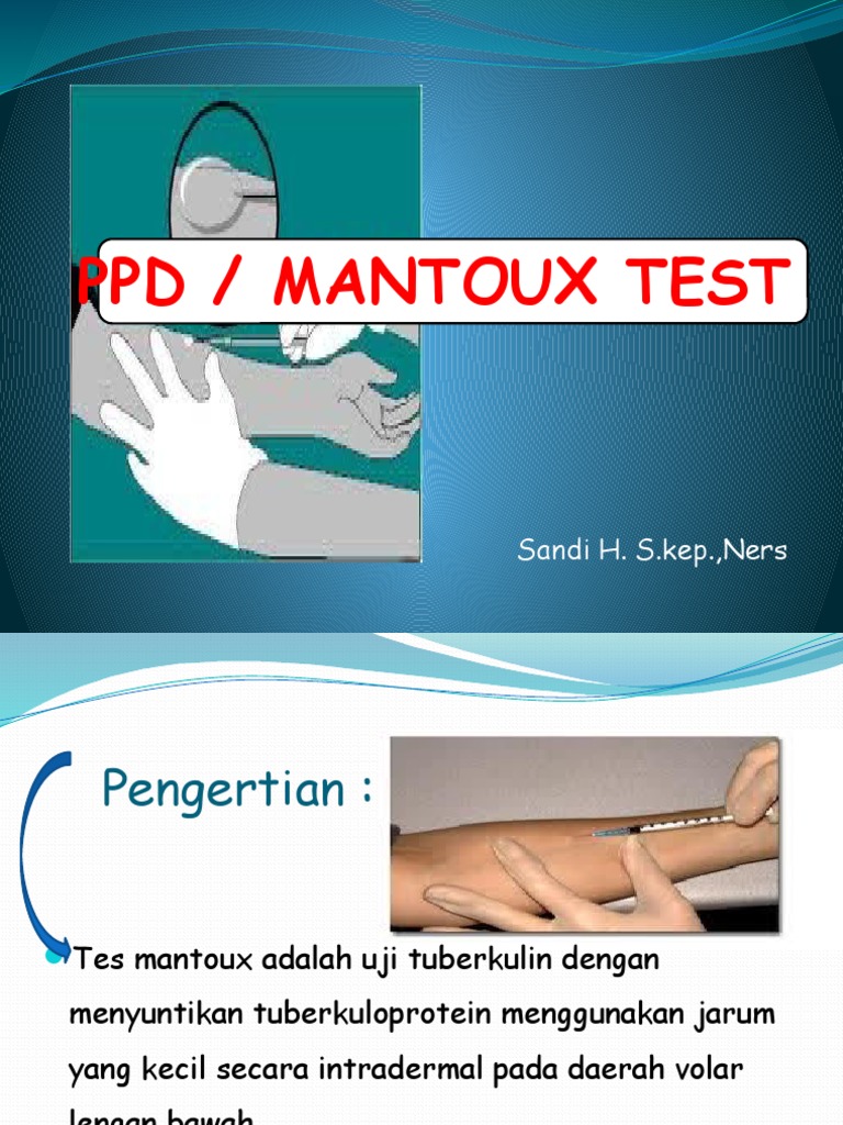 PPD / Mantoux Test: Sandi H. S.kep.,Ners | PDF