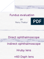 Fundus Examination is good for ocular health,and doing routine check up