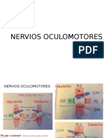 Paralisis Facial