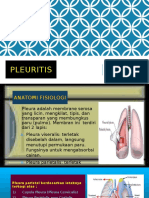 Pleuritis