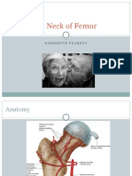 Fractured Neck of Femur